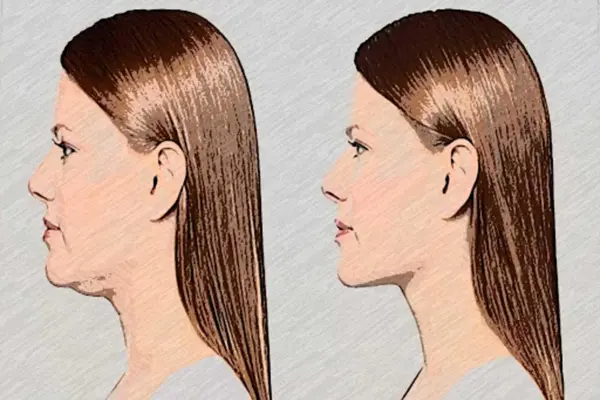 Double Chin Exercises android App screenshot 7